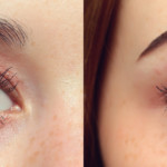 eye-spa-treatments